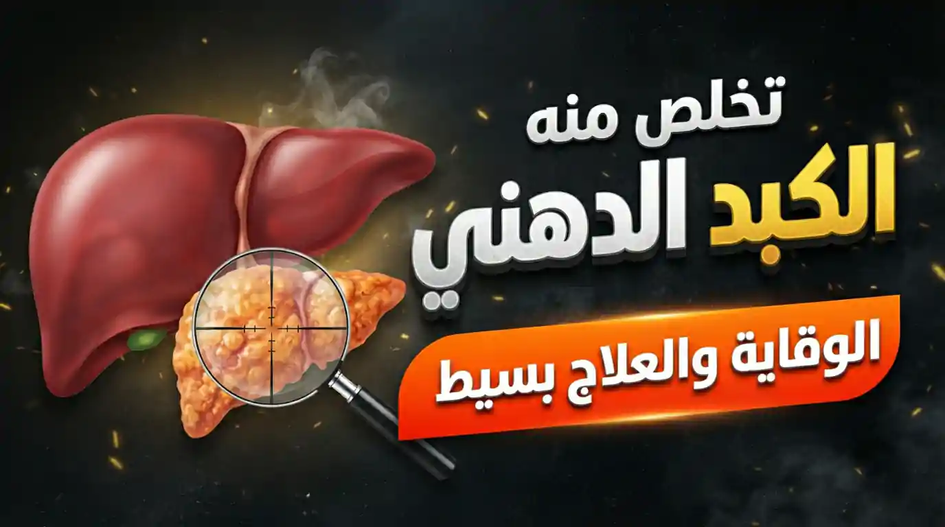 علاج الكبد الدهني