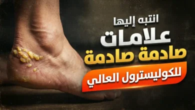 كولسترول الدم