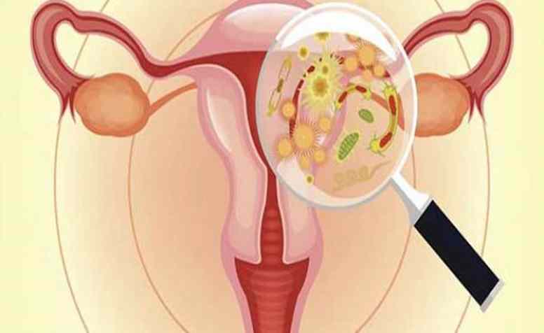 أسباب الحكة المهبلية والحرقان عند النساء وطرق علاجها
