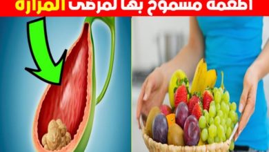 13 طعام مسموح به لمرضى المرارة و 7 ممنوعة