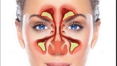 كيف تعرف أنك مصاب بالتهاب الجيوب الانفية؟