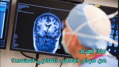 مرض التصلب العصبي المتعدد