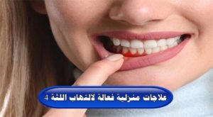 4 علاجات منزلية فعالة لالتهاب اللثة
