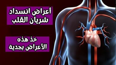 ما هي أعراض انسداد شريان القلب