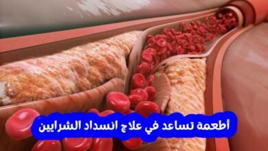 6 أطعمة تساعد في علاج انسداد الشرايين