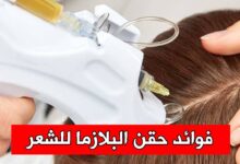 فوائد حقن البلازما للشعر