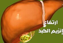 ارتفاع إنزيم الكبد