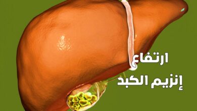 ارتفاع إنزيم الكبد