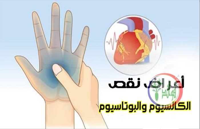اعراض نقص الكالسيوم والبوتاسيوم مع أفضل طرق العلاج